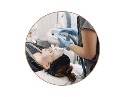 M22 IPL PHOTOFACIAL before and after care